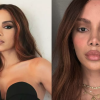 Anitta se pronuncia sobre plásticas no rosto e disse que está ótima